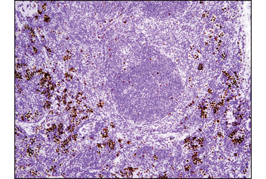 Immunohistochemistry Image 1: Phospho-Rb (Ser807/811) (D20B12) XP® Rabbit mAb (BSA and Azide Free)