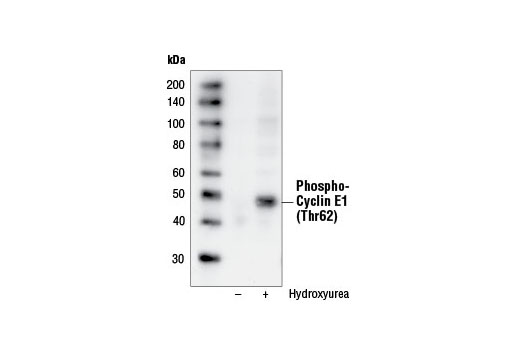 Western Blotting Image 2: Phospho-Cyclin E1 (Thr62) Antibody