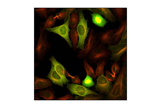Immunofluorescence Image 1: Cyclin B1 Antibody