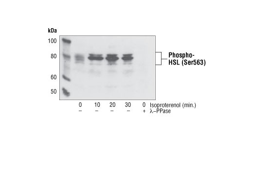 Western Blotting Image 1: Phospho-HSL (Ser563) Antibody