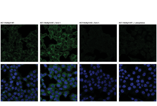 Immunofluorescence Image 1: Phospho-Atg14 (Ser29) (D4B8M) Rabbit mAb (BSA and Azide Free)