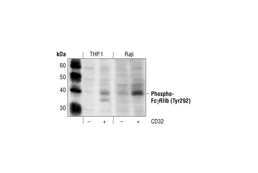 Western Blotting Image 1: Phospho-CD32 (FcgammaRIIb) (Tyr292) Antibody