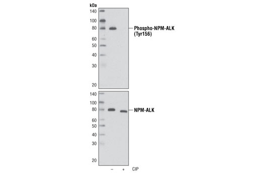 Western Blotting Image 1: Phospho-ALK (Tyr1096) Antibody