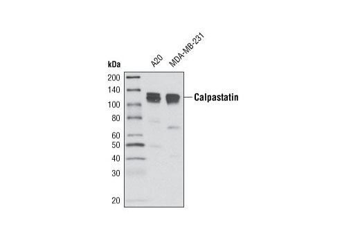 Western Blotting Image 1: Calpastatin Antibody