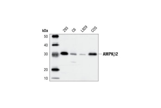  Image 5: AMPK Subunit Antibody Sampler Kit