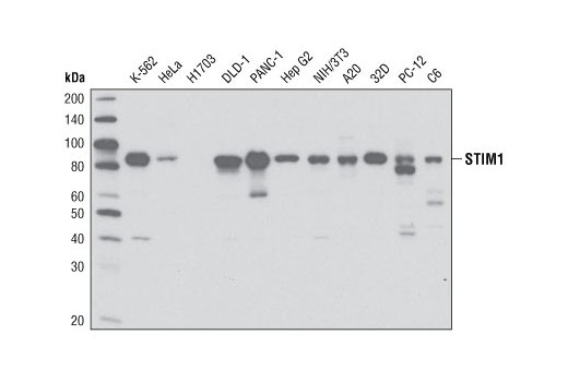 Western Blotting Image 1: STIM1 (G555) Antibody