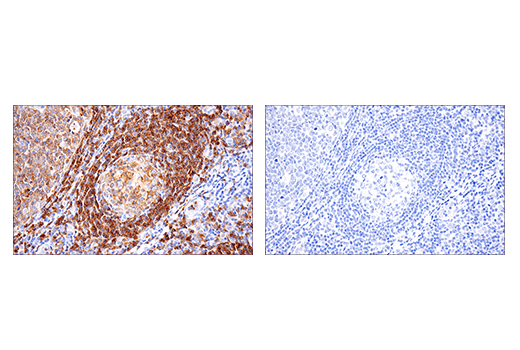 Immunohistochemistry Image 3: CD22 (E7L6Z) XP® Rabbit mAb (BSA and Azide Free)