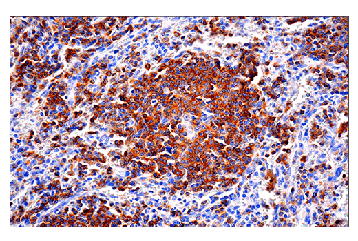 Immunohistochemistry Image 1: CD22 (E7L6Z) XP® Rabbit mAb (BSA and Azide Free)