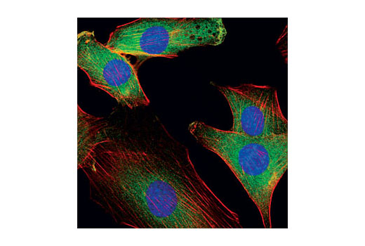 Immunofluorescence Image 1: AMPKβ1/2 (57C12) Rabbit mAb