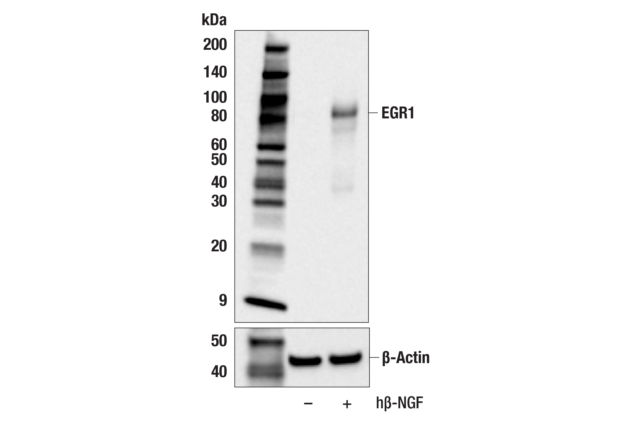 Western Blotting Image 2: EGR1 (15F7) Rabbit mAb