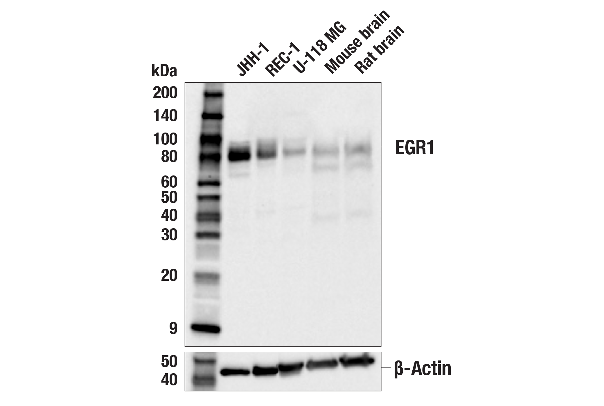 Western Blotting Image 1: EGR1 (44D5) Rabbit mAb