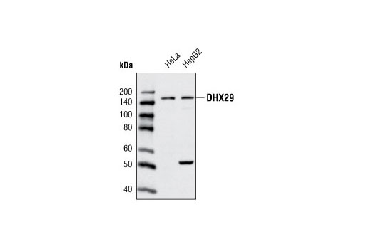 Western Blotting Image 1: DHX29 Antibody
