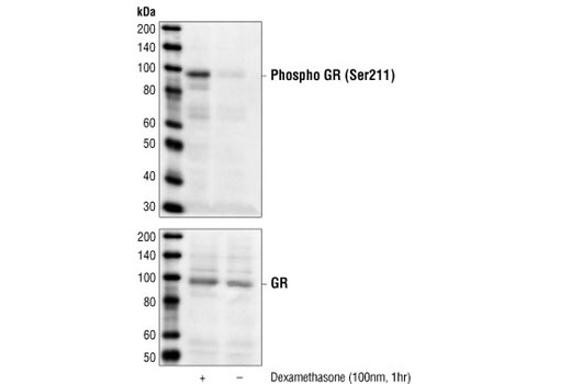 Western Blotting Image 1: Phospho-Glucocorticoid Receptor (Ser211) Antibody