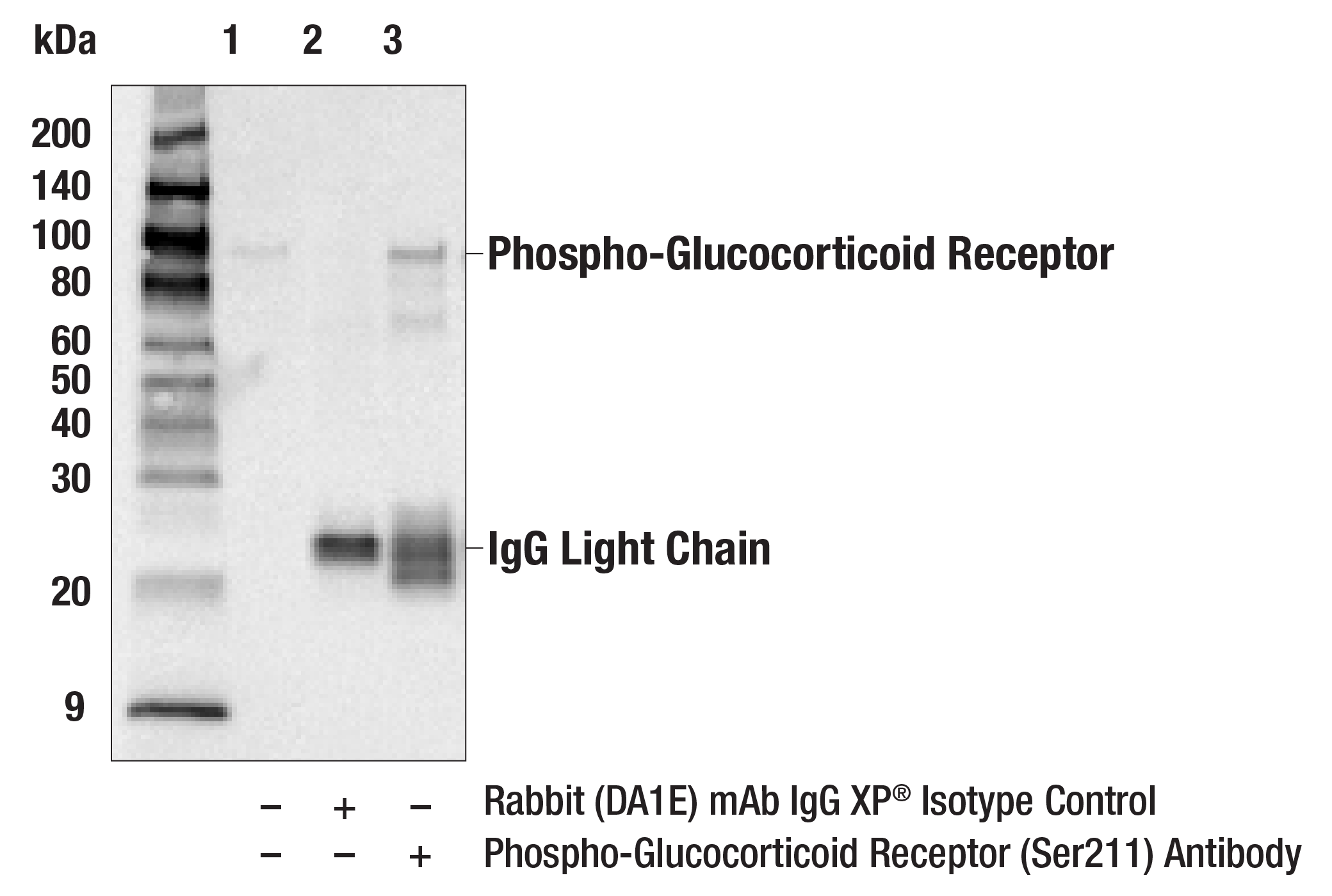 Immunoprecipitation Image 1: Phospho-Glucocorticoid Receptor (Ser211) Antibody