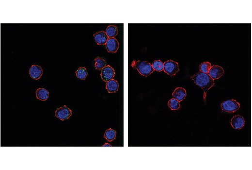 Immunofluorescence Image 1: Phospho-STING (Ser366) (D8K6H) Rabbit mAb (Alexa Fluor® 488 Conjugate)