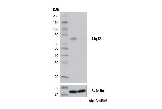 Western Blotting Image 3: Atg13 (D4P1K) Rabbit mAb (BSA and Azide Free)