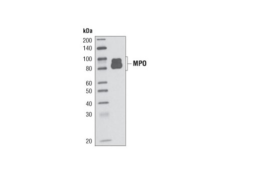 Western Blotting Image 1: Myeloperoxidase (P733) Antibody