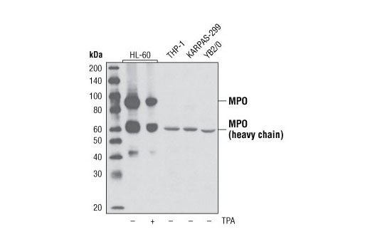 Western Blotting Image 2: Myeloperoxidase (P733) Antibody