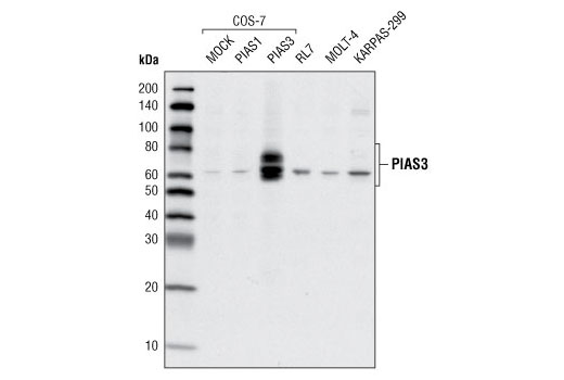 Western Blotting Image 1: PIAS3 Antibody