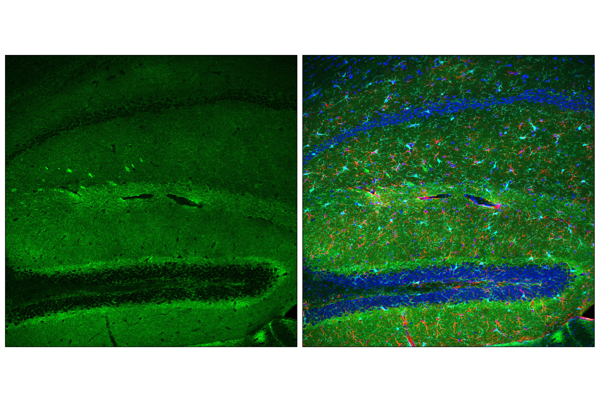 Immunofluorescence Image 1: GAP43 (E6L2W) Mouse mAb