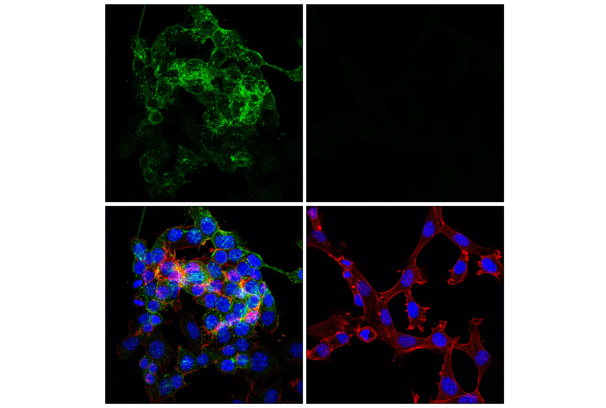 Immunofluorescence Image 2: GAP43 (E6L2W) Mouse mAb