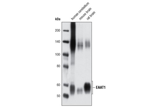 Western Blotting Image 1: EAAT1 Antibody