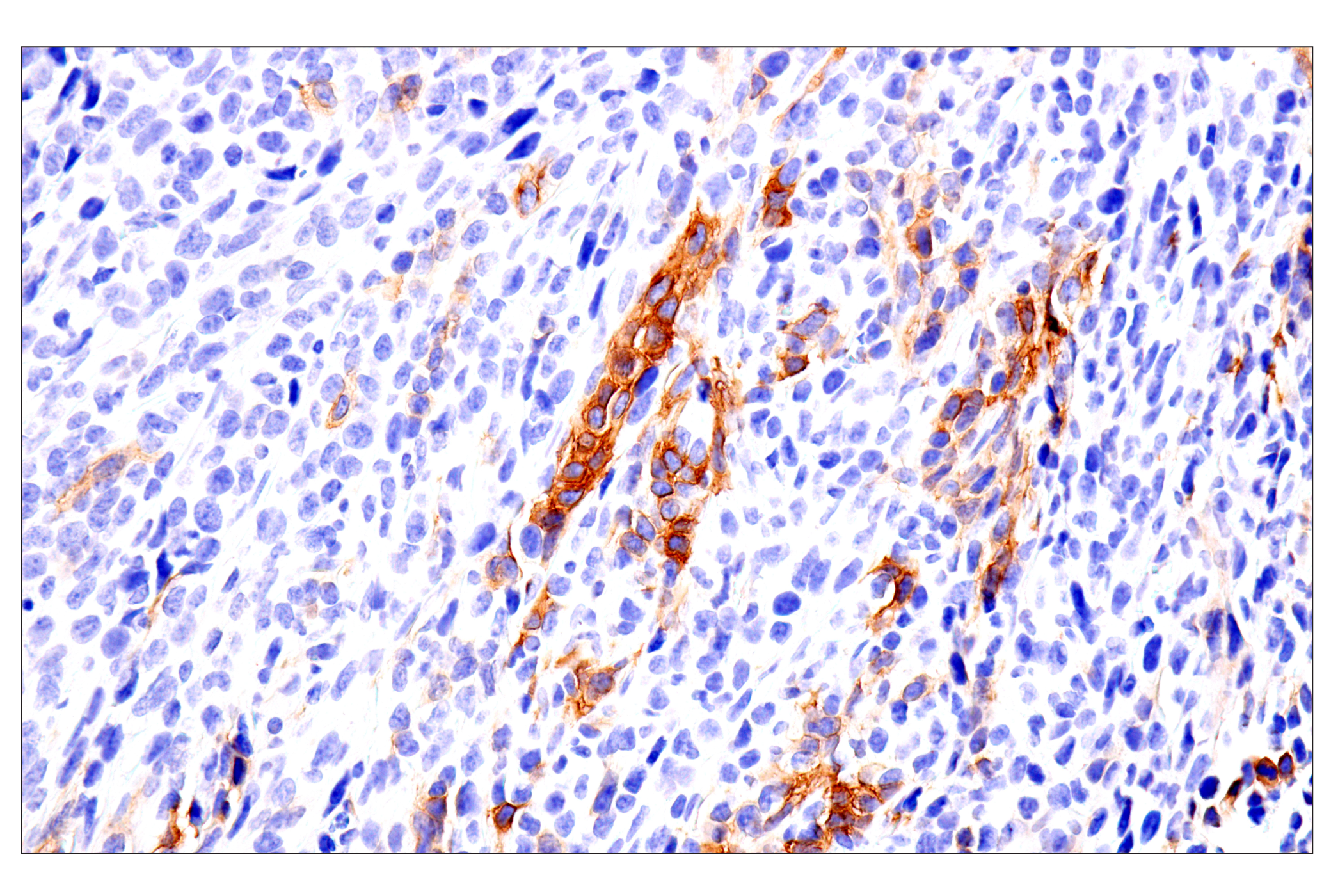 Immunohistochemistry Image 14: p75NTR (E7I3M) Rabbit mAb