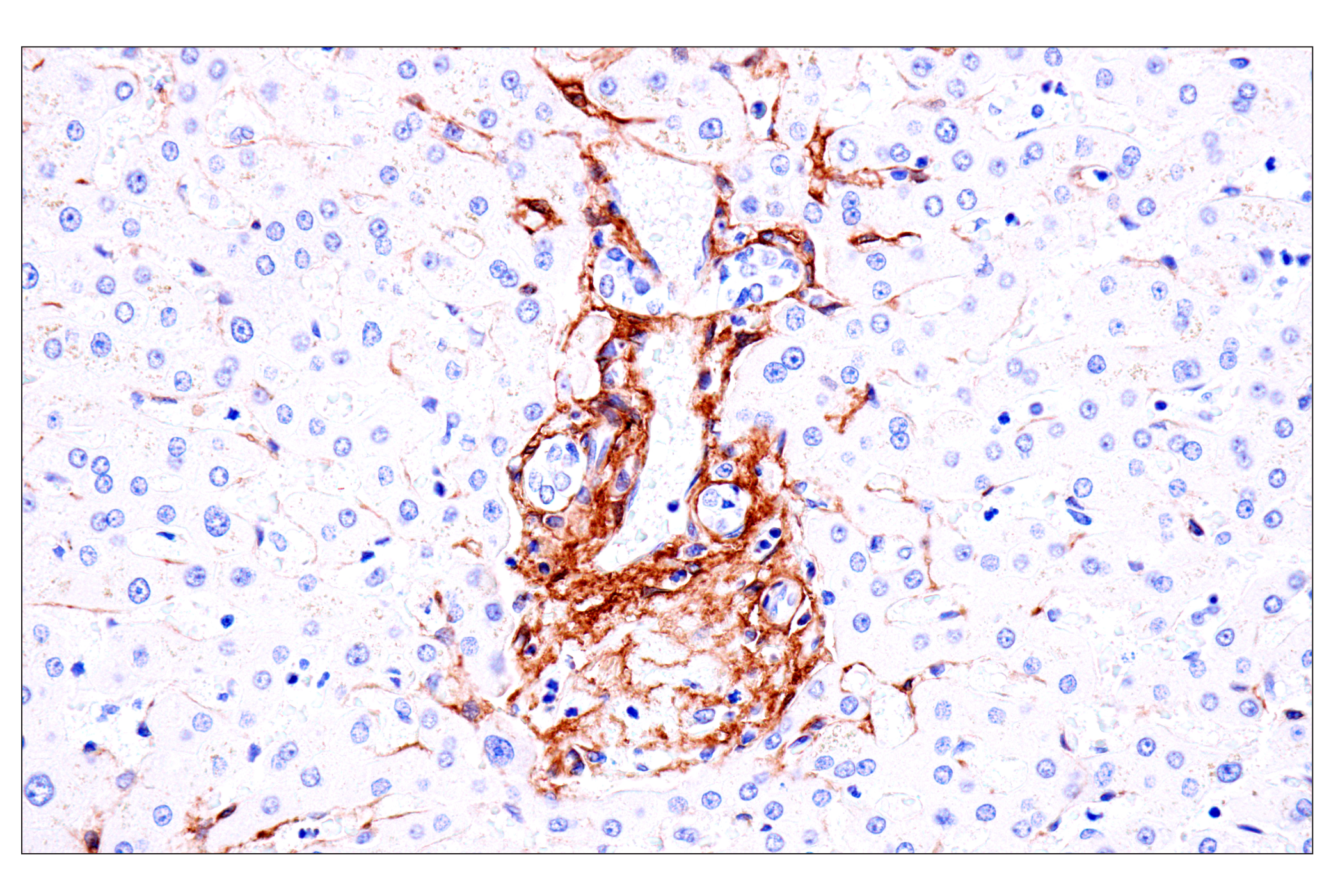 Immunohistochemistry Image 12: p75NTR (E7I3M) Rabbit mAb