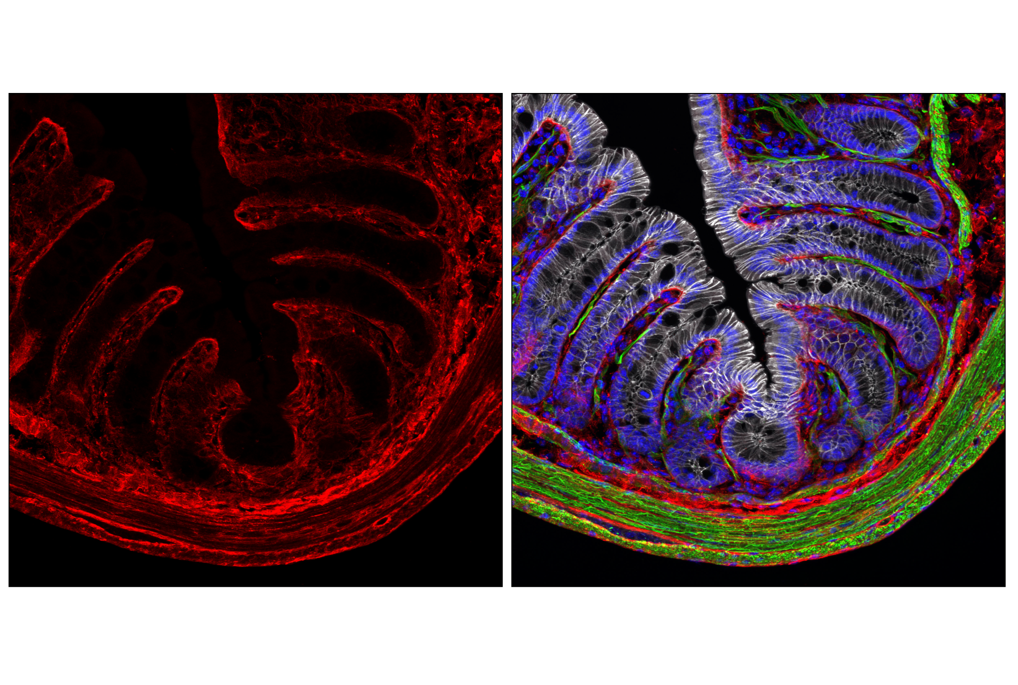 Immunofluorescence Image 1: COL1A1 (E8F4L) XP® Rabbit mAb (Alexa Fluor® 555 Conjugate)