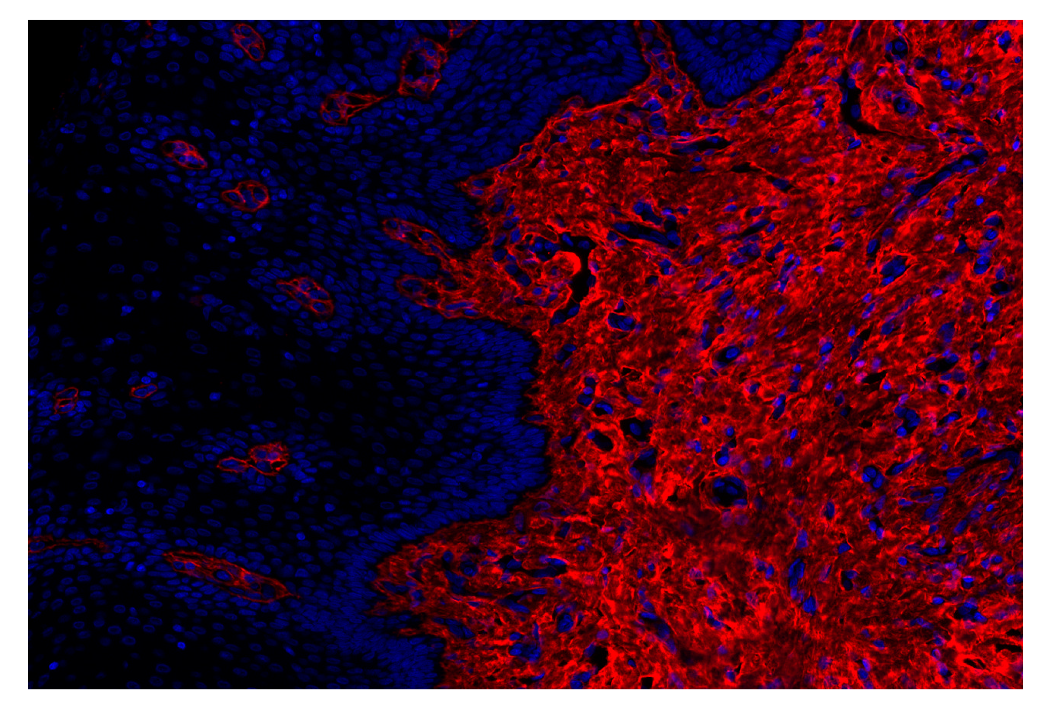Immunohistochemistry Image 2: COL1A1 (E8F4L) XP® Rabbit mAb (Alexa Fluor® 555 Conjugate)