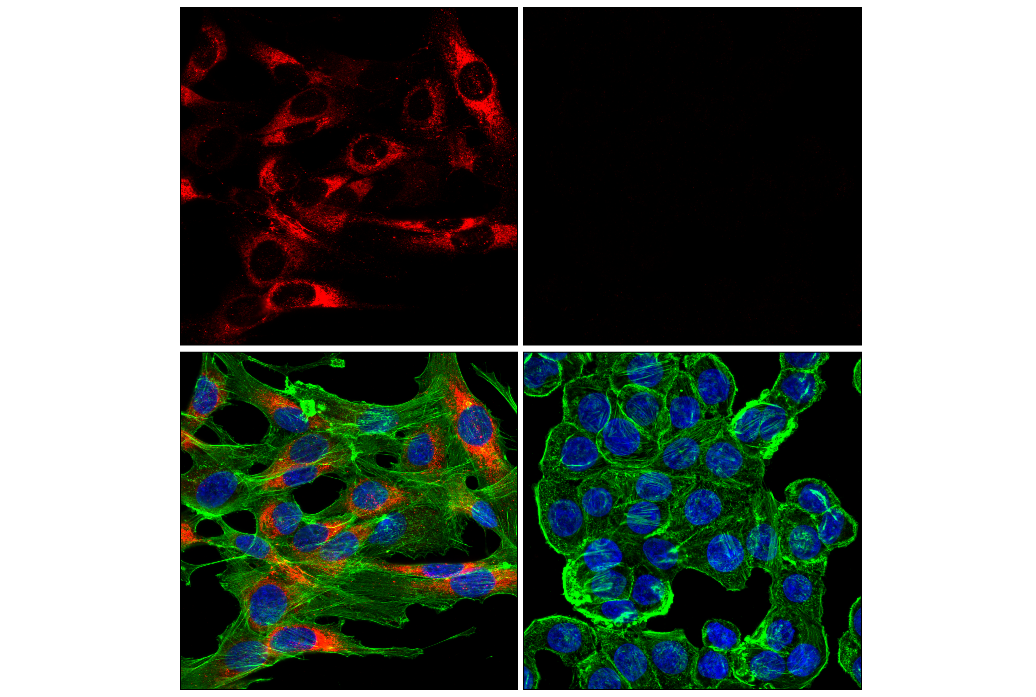 Immunofluorescence Image 4: COL1A1 (E8F4L) XP® Rabbit mAb (Alexa Fluor® 555 Conjugate)