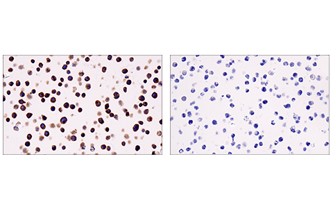 Immunohistochemistry Image 1: LAT (E3U6J) XP® Rabbit mAb (BSA and Azide Free)
