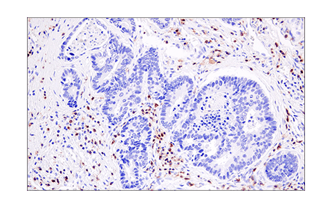 Immunohistochemistry Image 2: LAT (E3U6J) XP® Rabbit mAb (BSA and Azide Free)