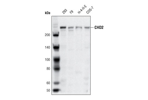 Western Blotting Image 1: CHD2 Antibody