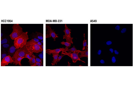 Immunofluorescence Image 1: PD-L1 (Extracellular Domain Specific) (D8T4X) Rabbit mAb (Alexa Fluor® 647 Conjugate)