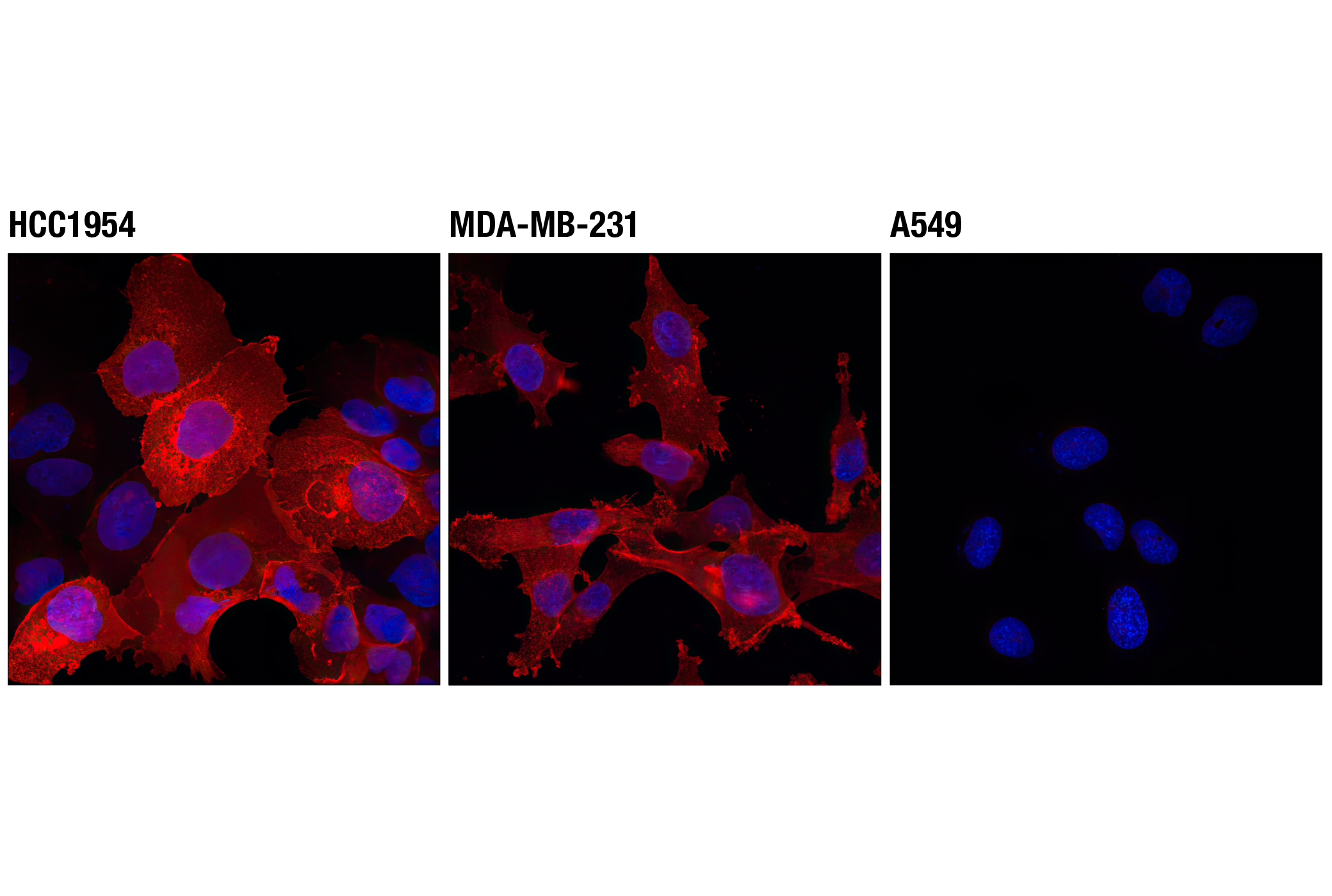 Immunofluorescence Image 1: PD-L1 (Extracellular Domain Specific) (D8T4X) Rabbit mAb (Alexa Fluor® 647 Conjugate)