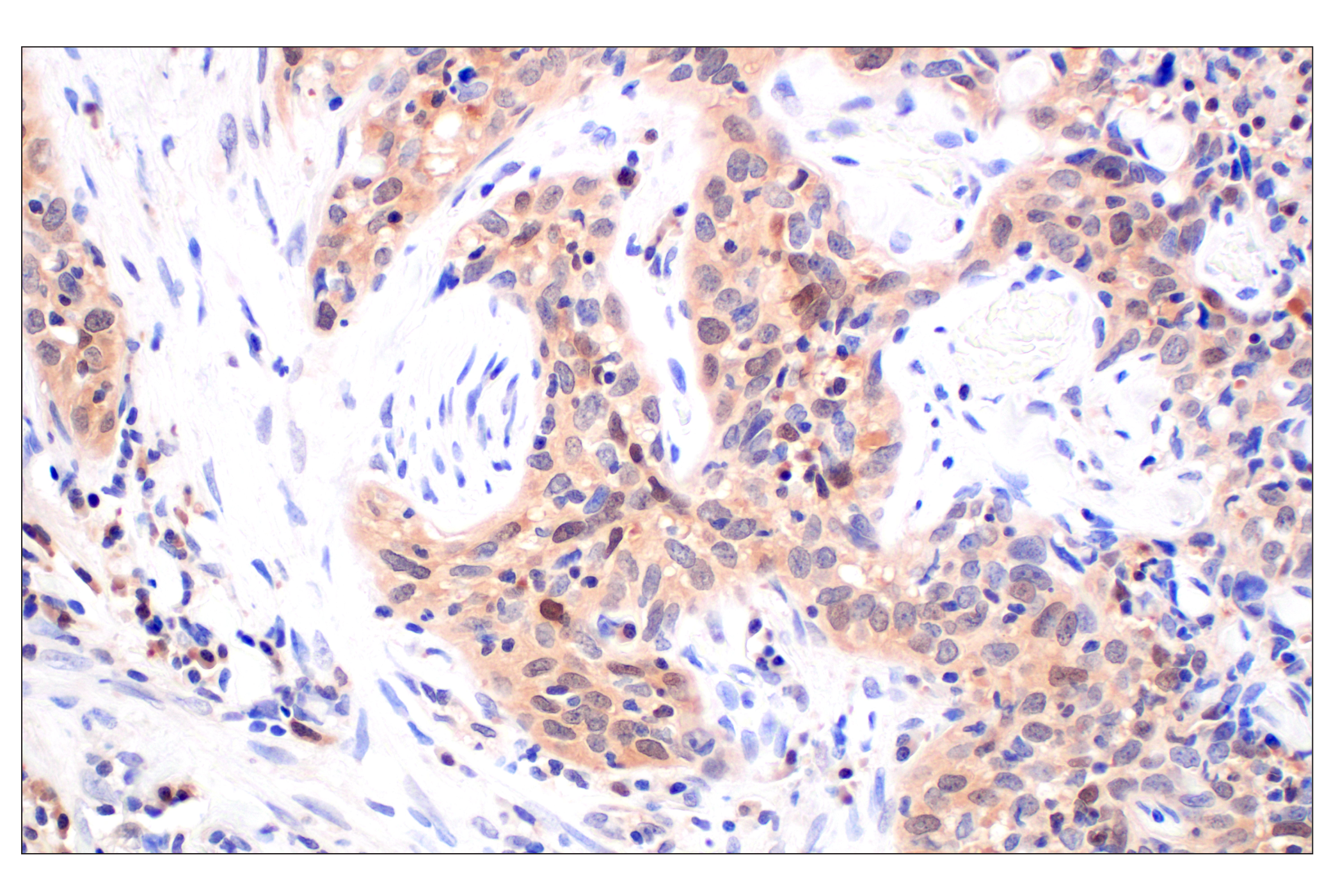 Immunohistochemistry Image 1: CDK6 (E3E3Q) Rabbit mAb (BSA and Azide Free)