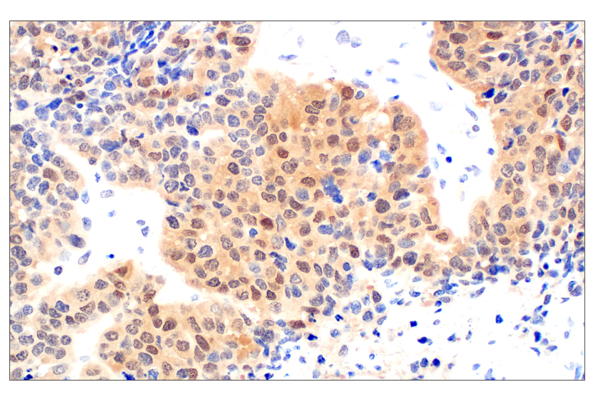 Immunohistochemistry Image 3: CDK6 (E3E3Q) Rabbit mAb (BSA and Azide Free)