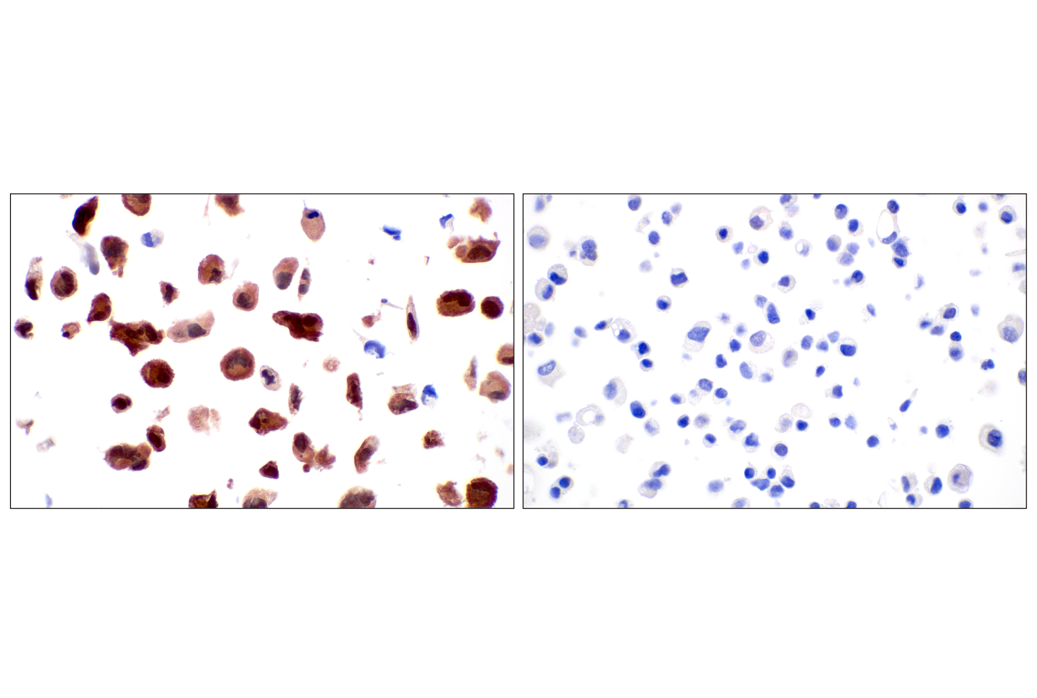 Immunohistochemistry Image 18: CDK6 (E3E3Q) Rabbit mAb (BSA and Azide Free)
