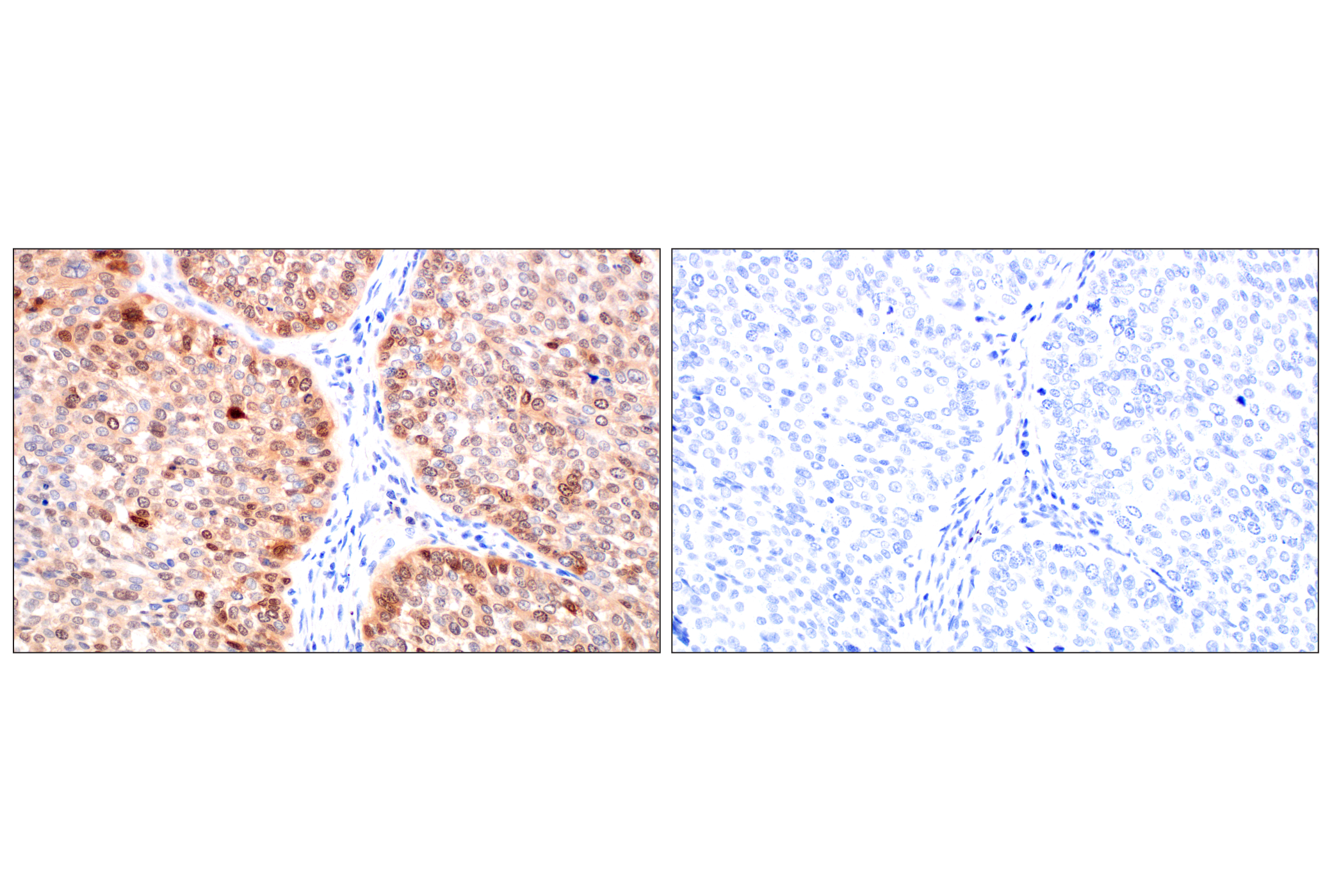 Immunohistochemistry Image 17: CDK6 (E3E3Q) Rabbit mAb (BSA and Azide Free)