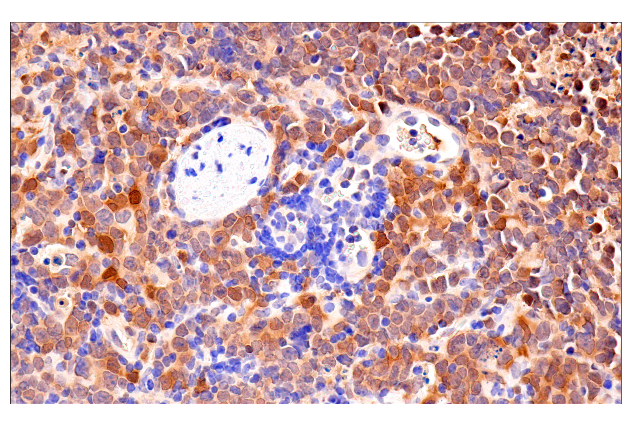 Immunohistochemistry Image 7: CDK6 (E3E3Q) Rabbit mAb (BSA and Azide Free)