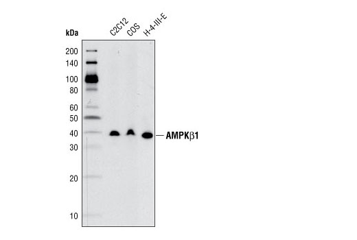  Image 6: AMPK Subunit Antibody Sampler Kit