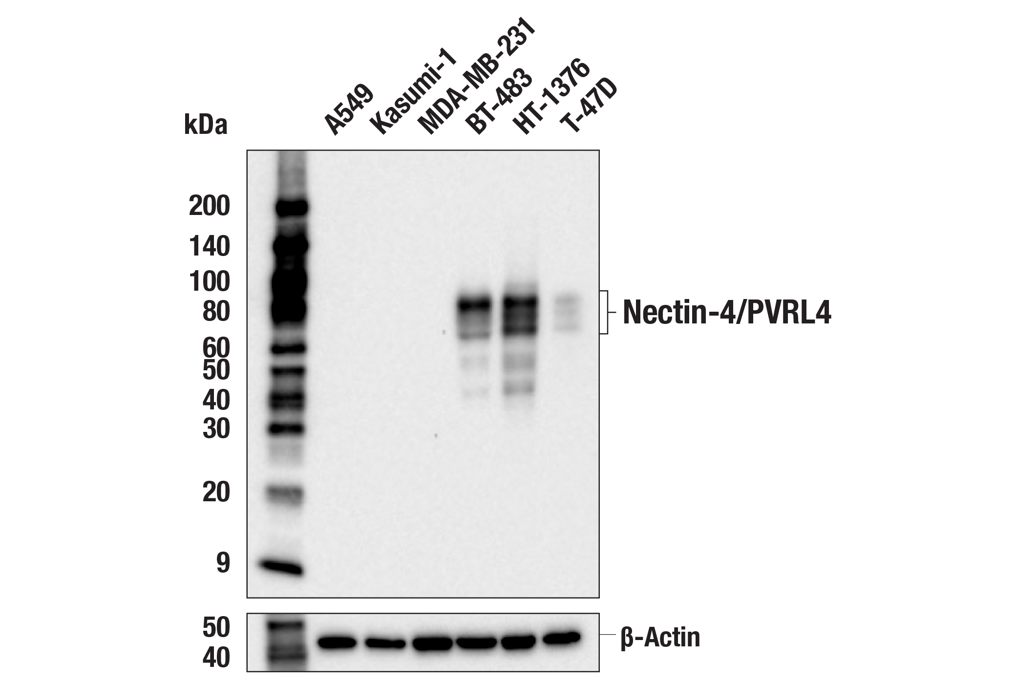 Western Blotting Image 1: Nectin-4/PVRL4 (E5Q1W) Rabbit mAb