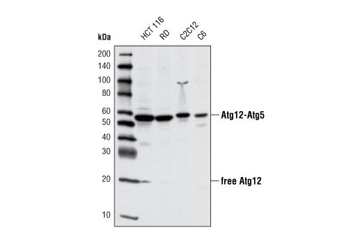  Image 2: Autophagy Vesicle Elongation (Atg12 Conjugation) Antibody Sampler Kit