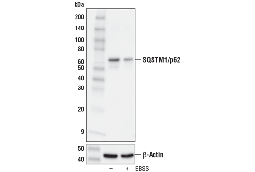 Western Blotting Image 2: SQSTM1/p62 (D1Q5S) Rabbit mAb (BSA and Azide Free)