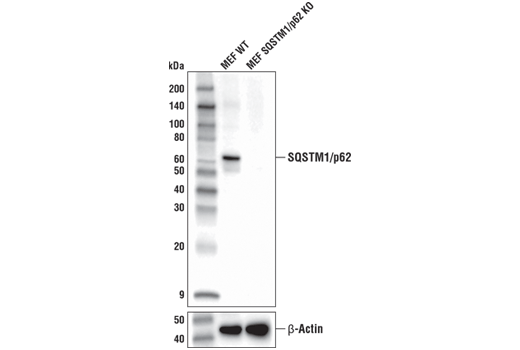 Western Blotting Image 3: SQSTM1/p62 (D1Q5S) Rabbit mAb (BSA and Azide Free)