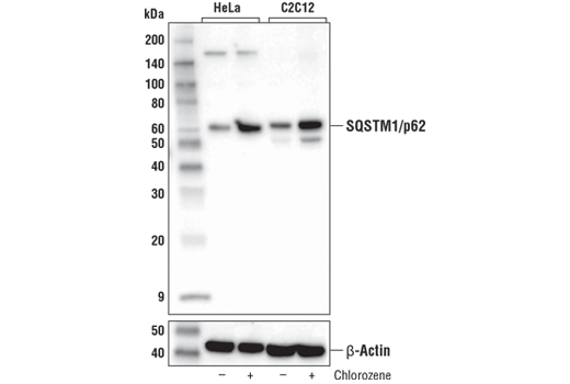 Western Blotting Image 4: SQSTM1/p62 (D1Q5S) Rabbit mAb (BSA and Azide Free)