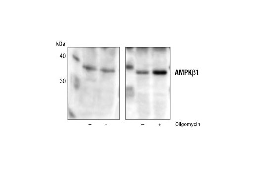 Immunoprecipitation Image 1: AMPKβ1 Antibody