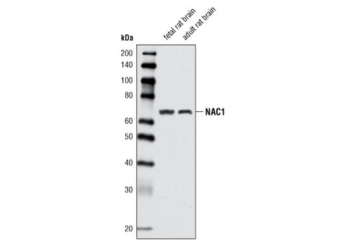 Western Blotting Image 2: NAC1 Antibody