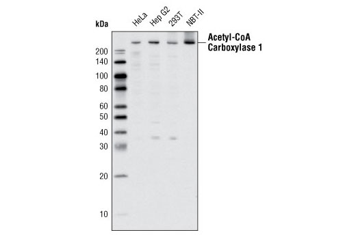 Western Blotting Image 2: Acetyl-CoA Carboxylase 1 Antibody